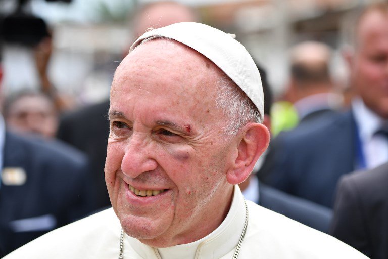  Papa se hiere el rostro en Cartagena…