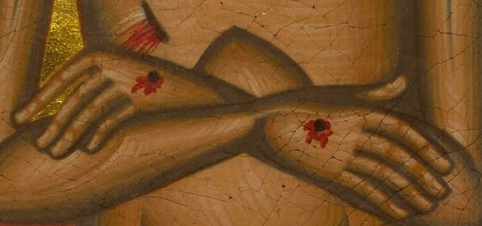 Wounded-Hands