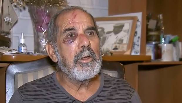  Desgarrador relato de hombre de 69 años golpeado por Carabinero